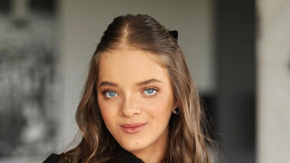 Antes da rinoplastia, Rafaella Justus passou por outra cirurgia plástica no rosto; procedimento altera formação óssea e a face!