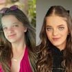 Antes e depois de Rafa Justus em 50 fotos: da infância à rinoplastia e ortognática, filha de Ticiane Pinheiro e Roberto Justus mudou MUITO e vai te impressionar