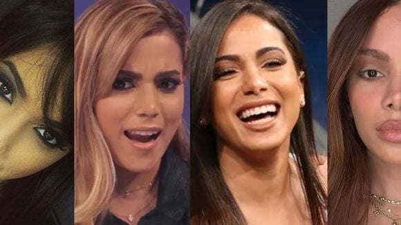 Por que Anitta fez tantas plásticas? Um detalhe específico mudou TUDO na vida da cantora e a aproximou de vez do bisturi